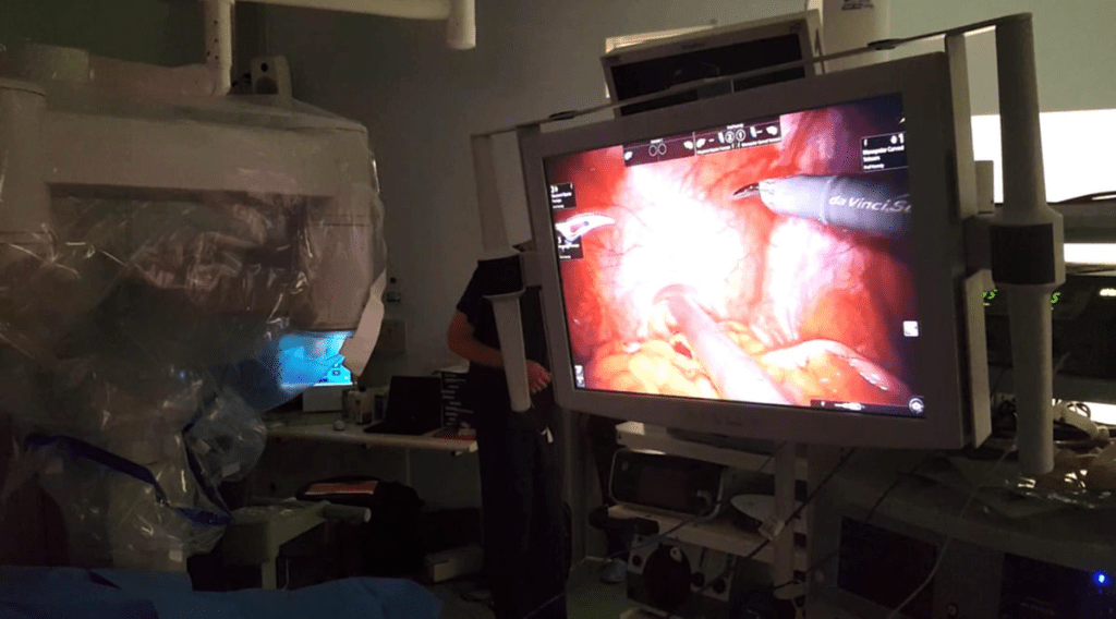 Transurethral Resection of the Prostate: Better Procedure