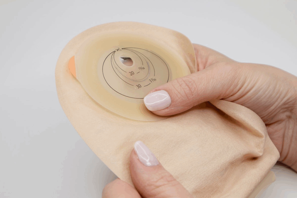 Colostomy Bag: Definition, Types & Meaning