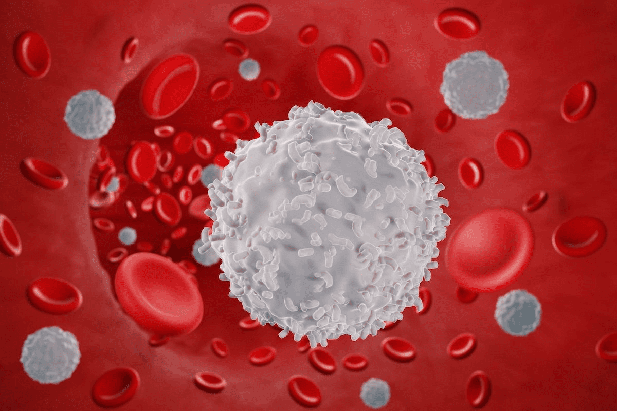 High Leukocyte in Urine: How Pregnancy Affects Levels