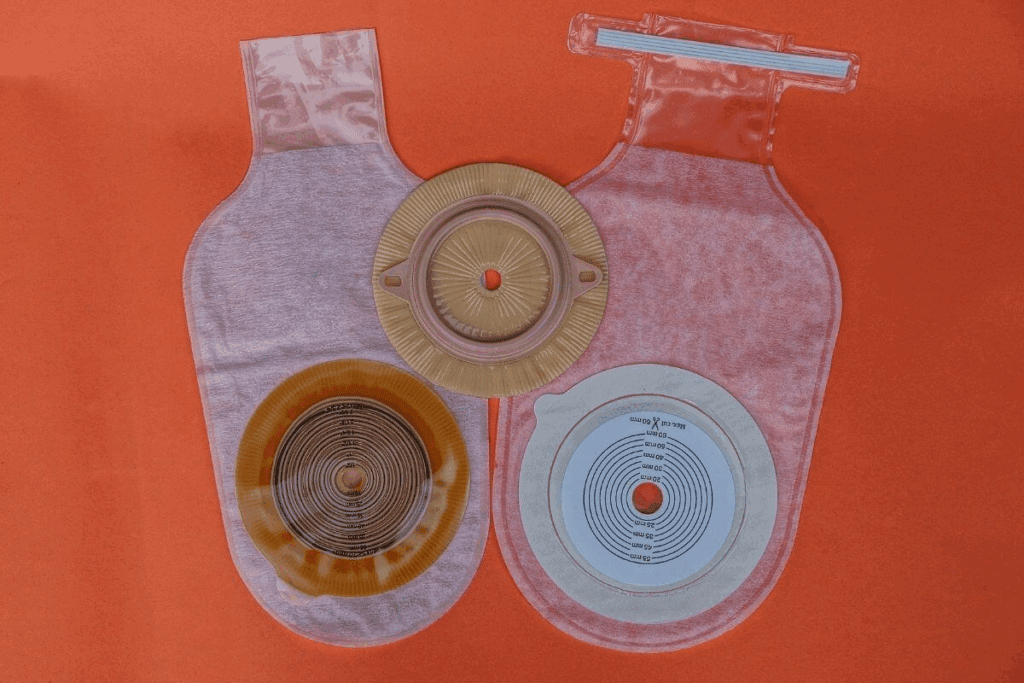 Colostomy Hole: Causes, Procedure & Care