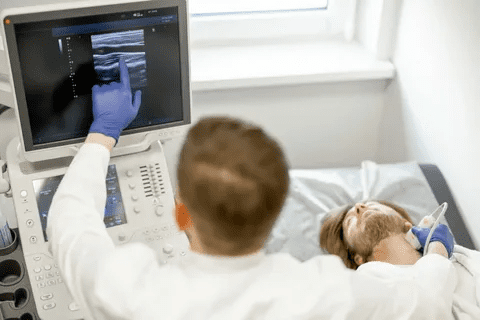 CEA Vascular Procedure: 7 Key Facts to Know