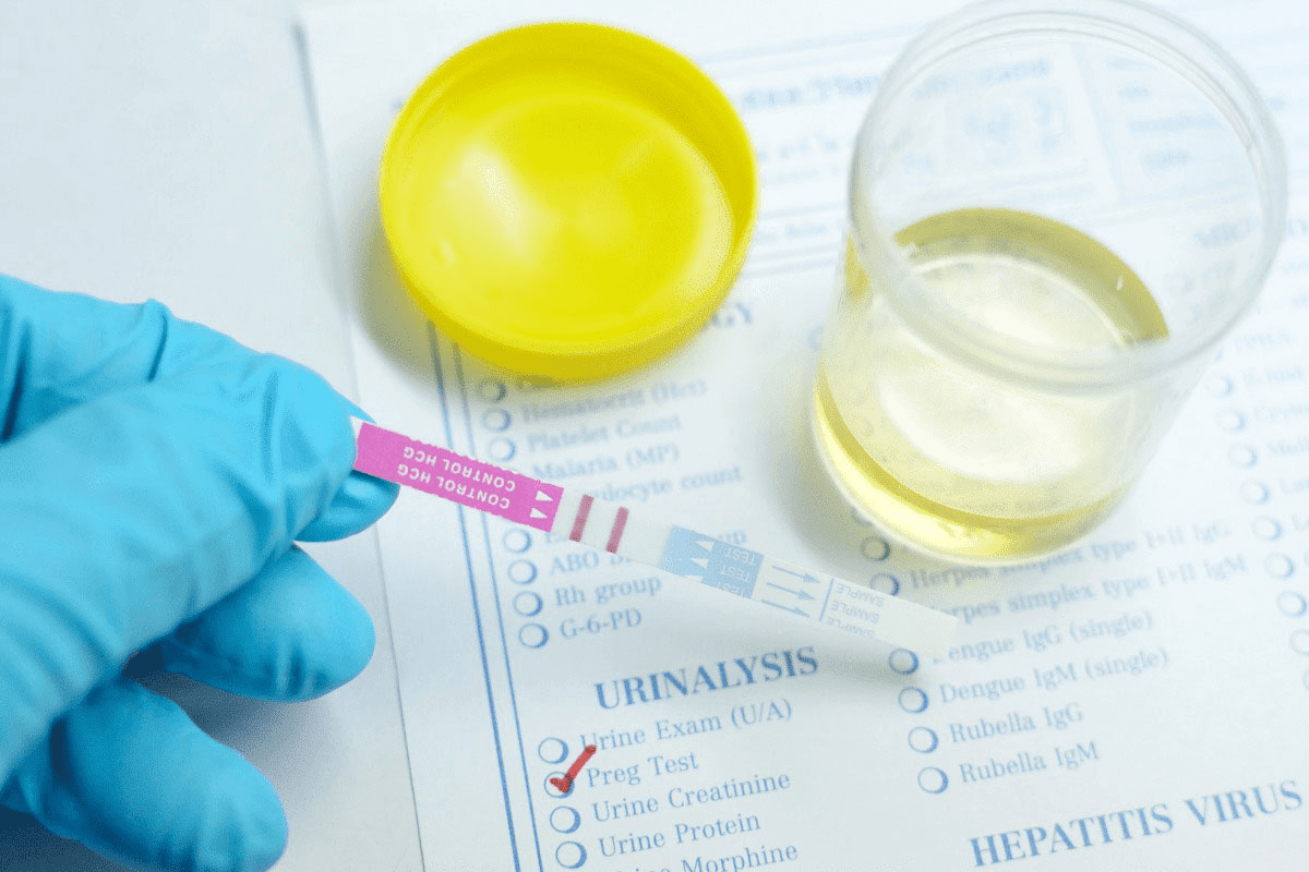 What Makes a Bad Urinalysis Result? Leukocyte Esterase