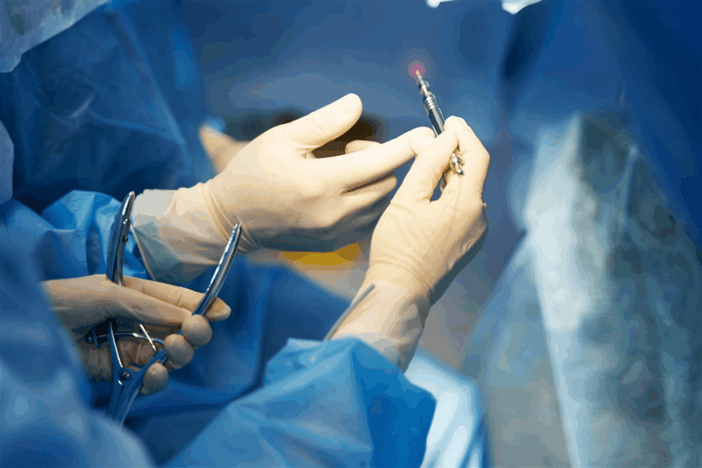 Recovery of Stent Procedure: The Ultimate Guide