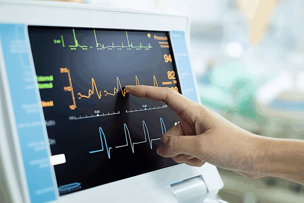 Atrial Tachycardia vs Atrial Fibrillation: 7 Facts