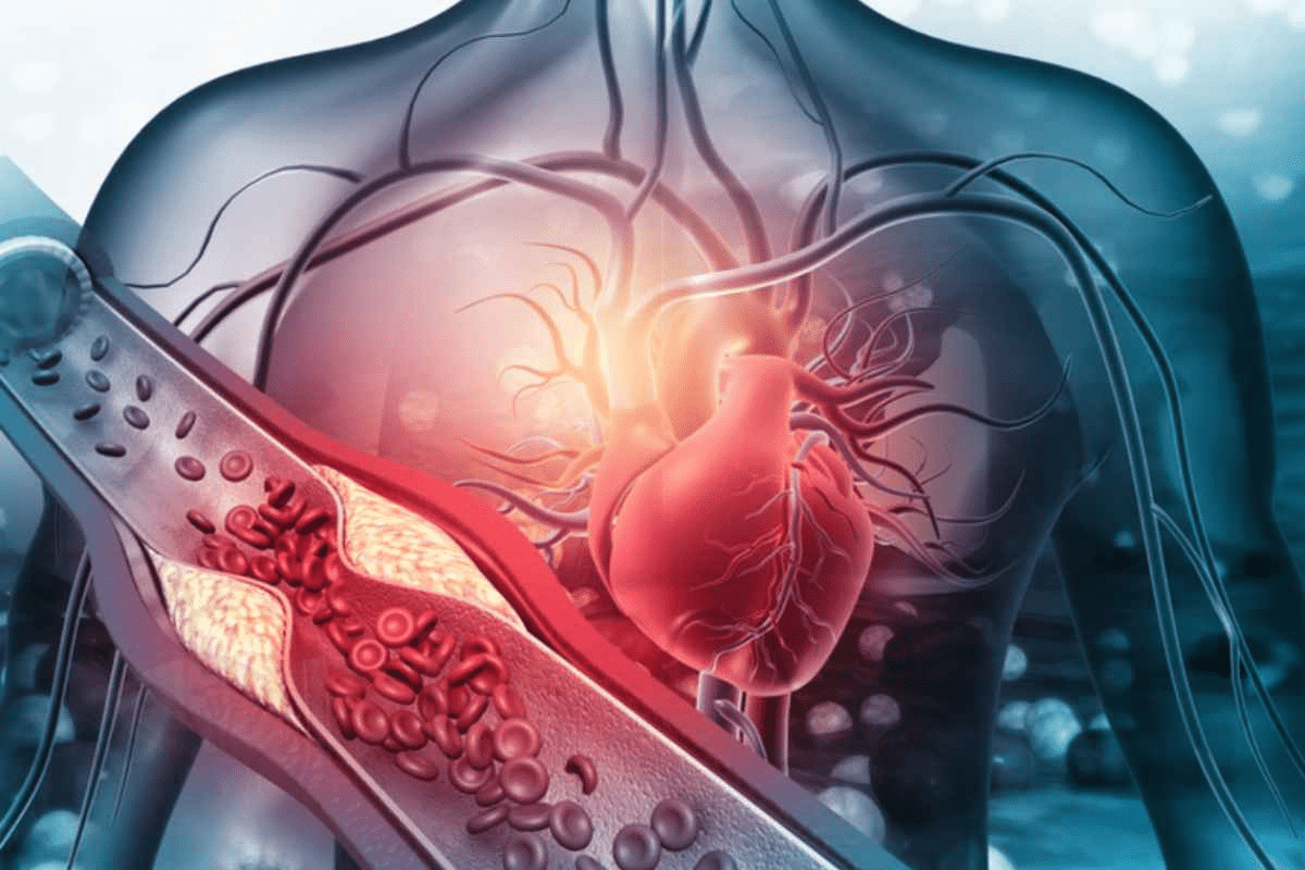 Arterial Function: How It Affects Blood Flow