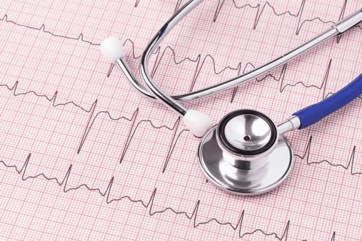 Arrhythmia Versus Dysrhythmia: Full Comparison