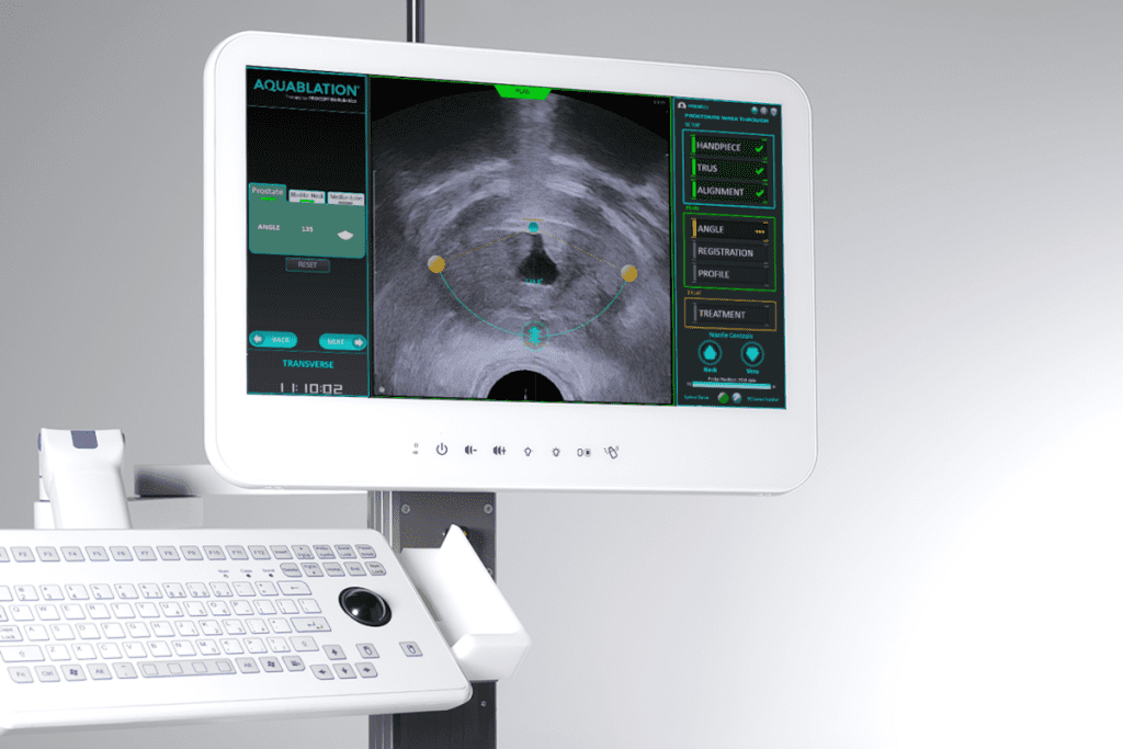 Flomax: Successful Enlarged Prostate Treatment 3 Flomax: Successful Enlarged Prostate Treatment