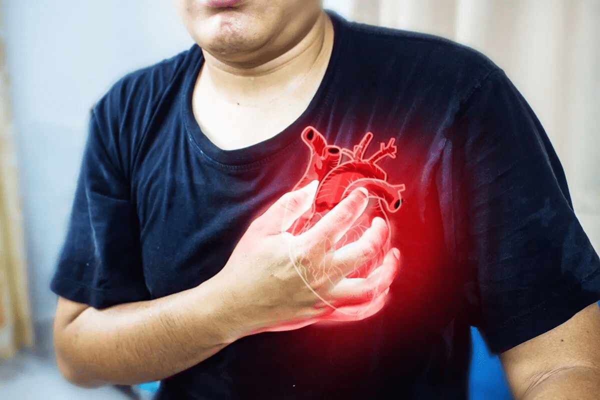 What Is Cardiomyopathy? Explained