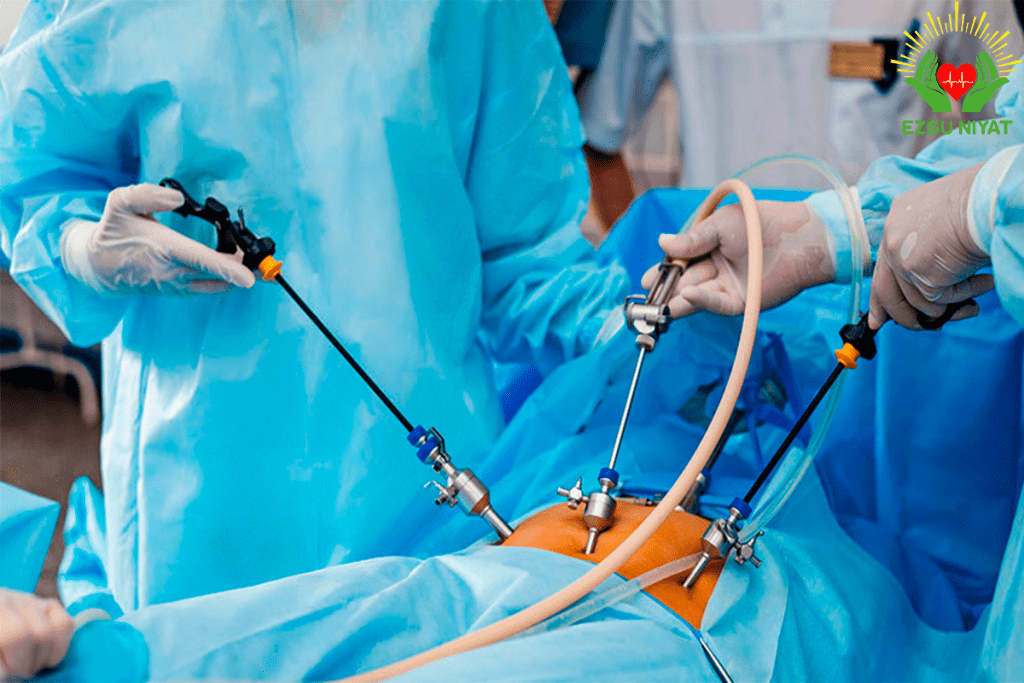 Prostatectomy: Removing It a Big Operation 1 Prostatectomy: Removing It a Big Operation