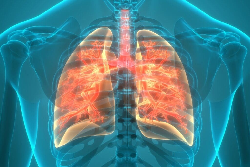Stage 1 Pulmonary Disease: Understanding Stages of Interstitial Lung Disease