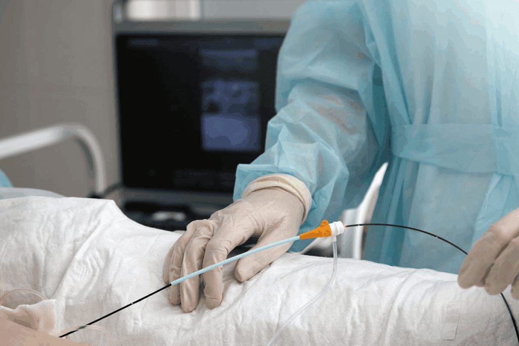 Radiofrequency Ablation Surgery: 7 Key Facts About Heart Arrhythmia Treatment 1 Radiofrequency Ablation Surgery: 7 Key Facts About Heart Arrhythmia Treatment