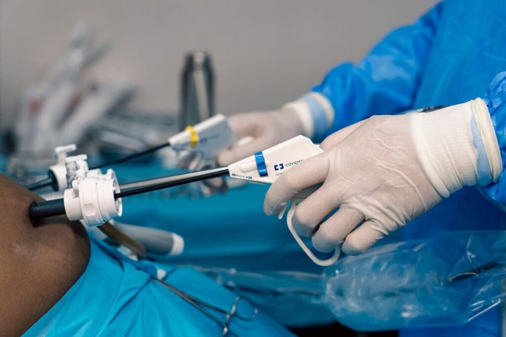 Anesthesia for Hernia: Do You Sleep For Hernia Surgery?