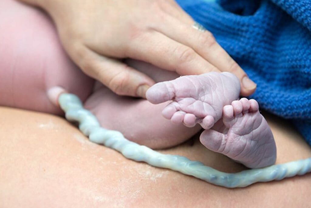 Rise in Birth Defects: Understanding the Defect Trends