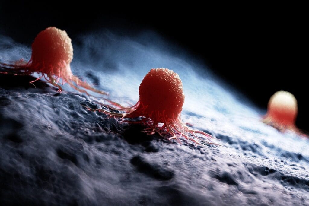 Tumor Growth Rates: Faster Than a Benign Tumor?