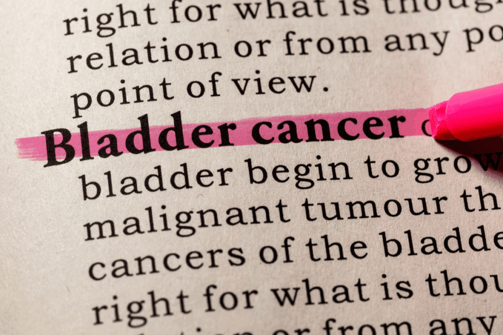 Urothelial Cancer Symptoms: Early Signs You Should Know