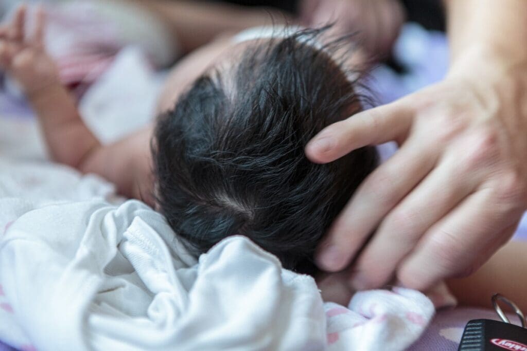 Leading Cause of Birth Defects: Understanding Fetal Alcohol Syndrome