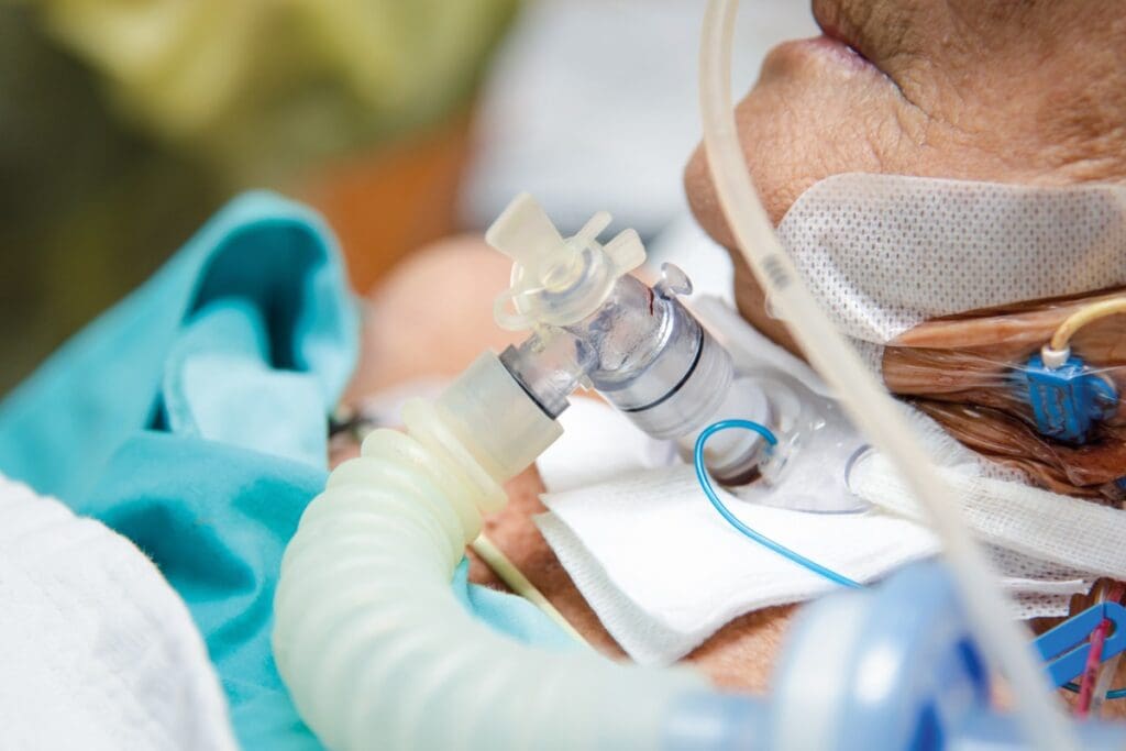 Stertor: Sign of This Common Obstruction