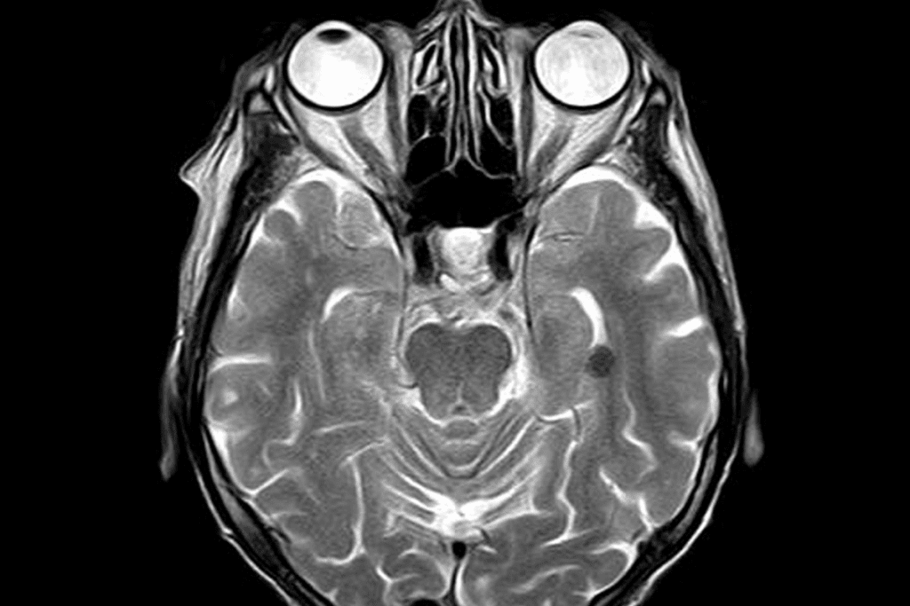 Shocking Truth: Why are Doctors Reluctant to Order? who can order an mri