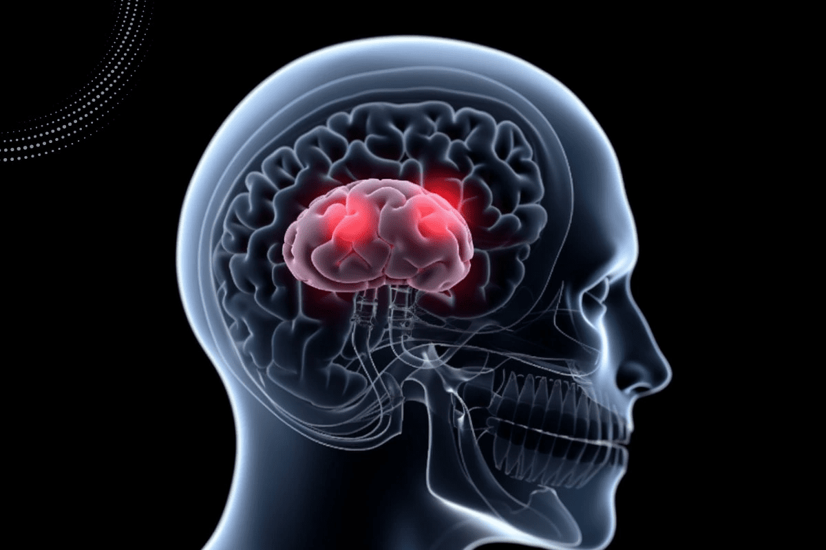 Lung cancer mets to brain: Learn the symptoms of brain metastasis from lung cancer and the available treatment options.