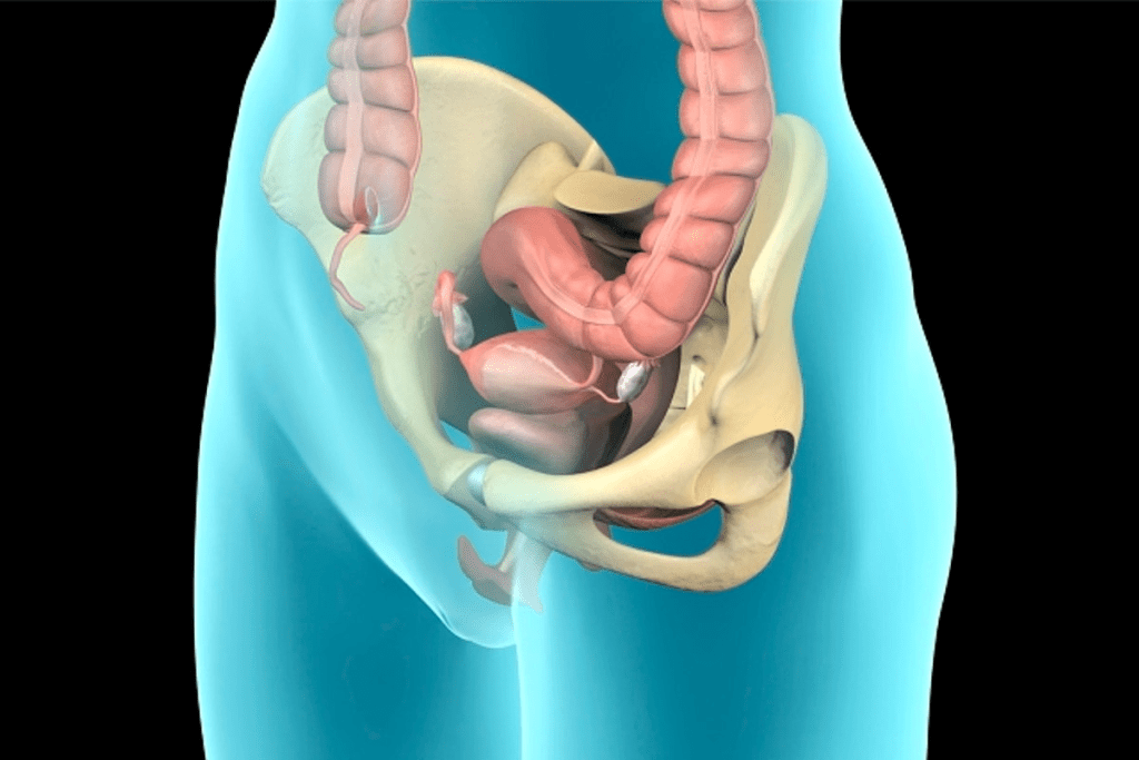 Bladder Sling: Common Name for Bladder Repair Surgery