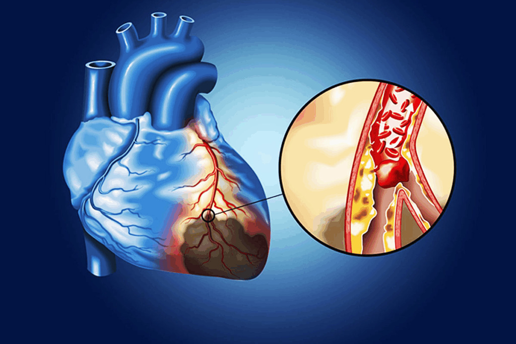 Heart Apnea: How Sleep Affects Heart 2 Heart Apnea: How Sleep Affects Heart