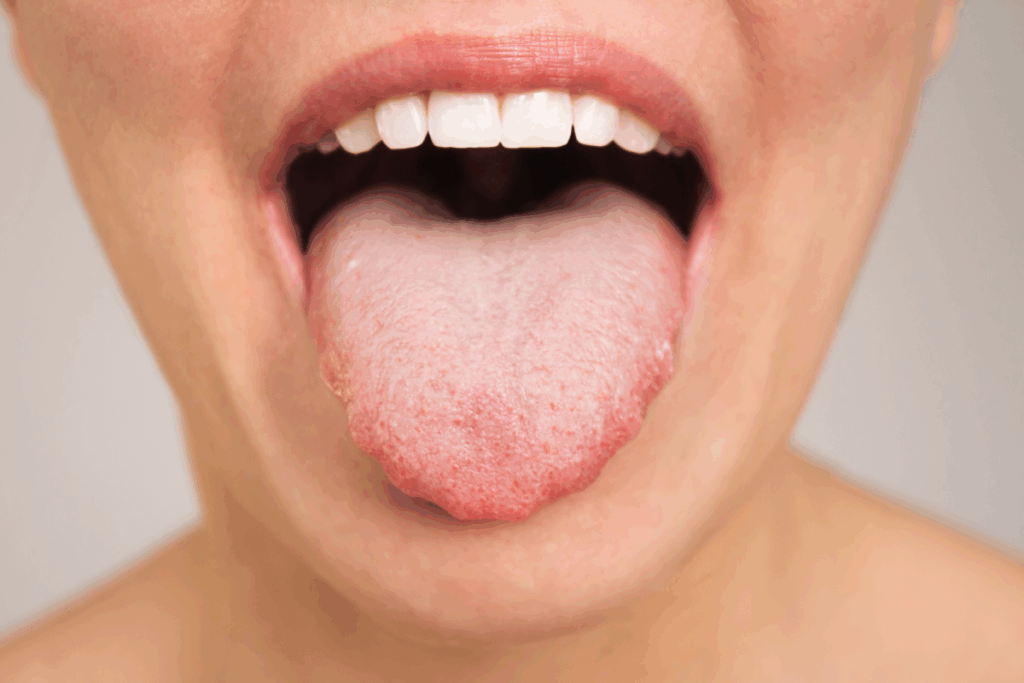 Early Signs of Tongue Cancer: What to Know
