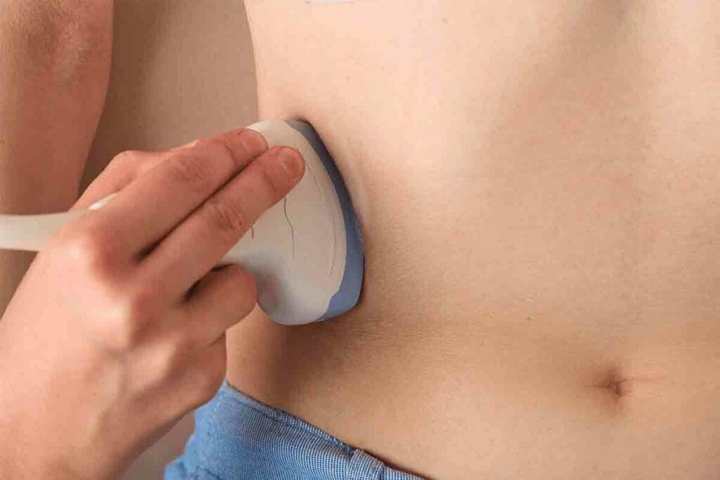 Renal Scintigraphy: How It Works and Uses