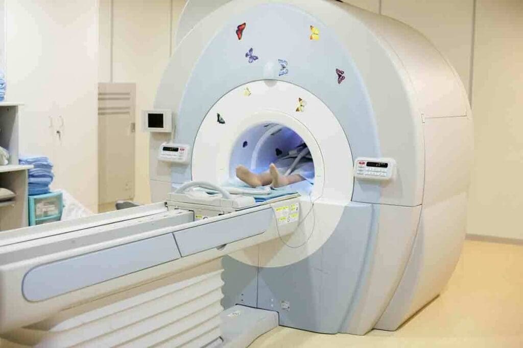 How Many Chest X Rays Are Safe in a Year? Best Guide