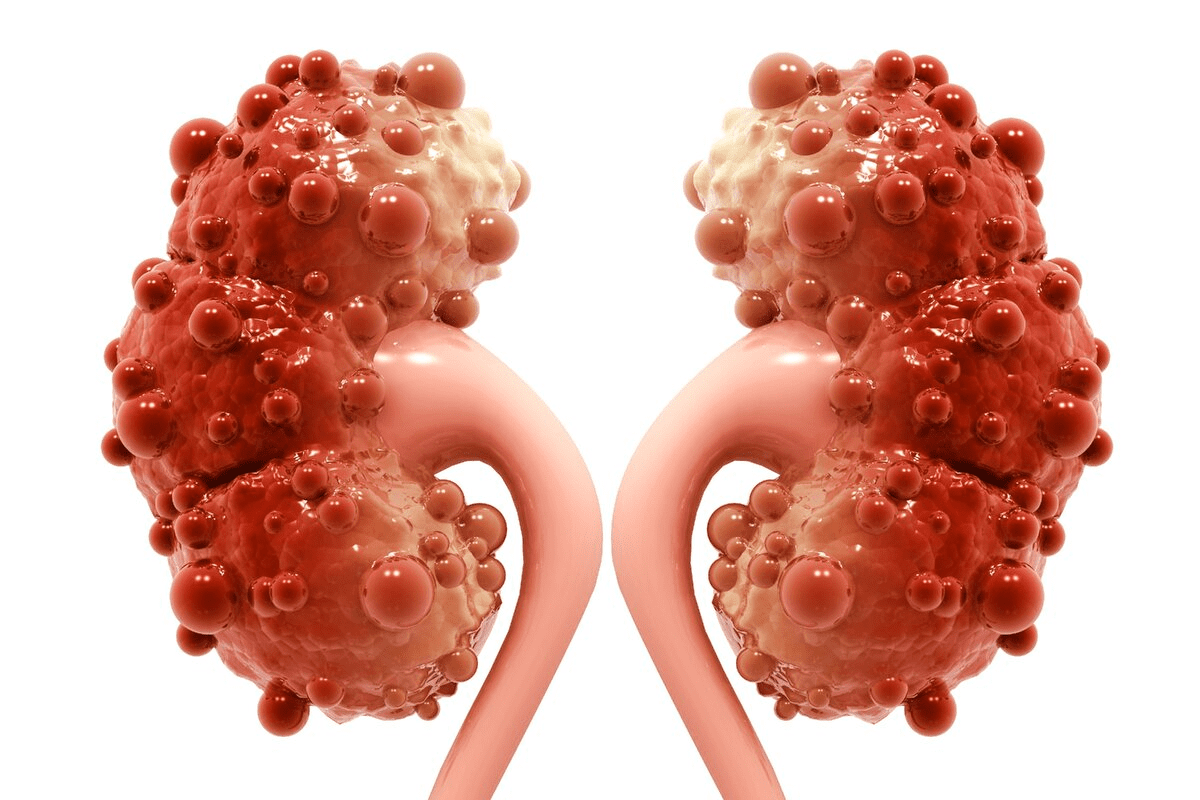 CKD Stages: eGFR Levels and Symptoms