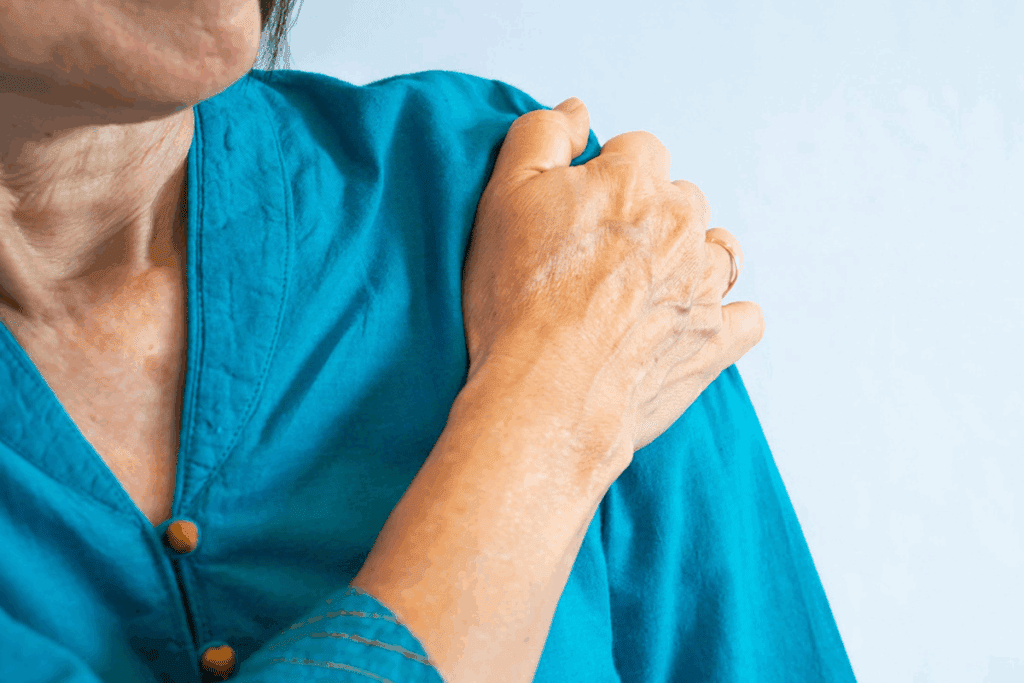 What Is the Special Test for Shoulder Impingement