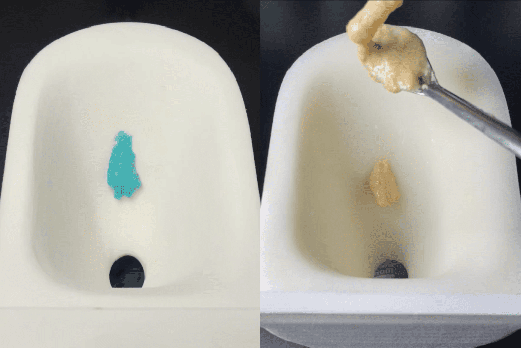 Penile Fistula Warning: How to Poop Safely After Surgery