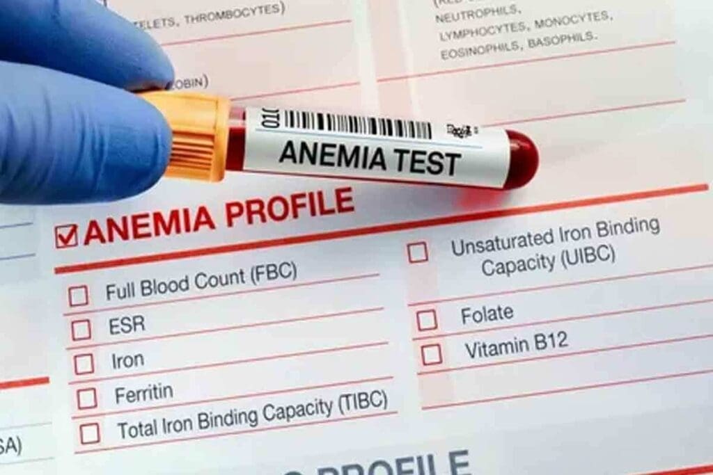 What Is Acute Blood Loss Anemia and How Is It Clinically Recognized?