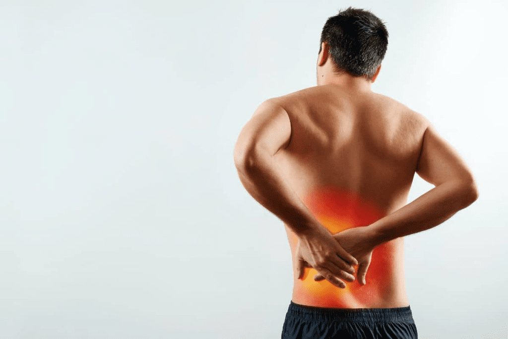 Kidney Stones: Your Ultimate Exercise Relief Guide