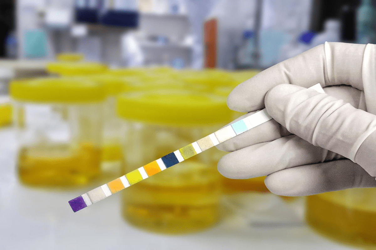 UTI: Guide to Stopping Recurrences