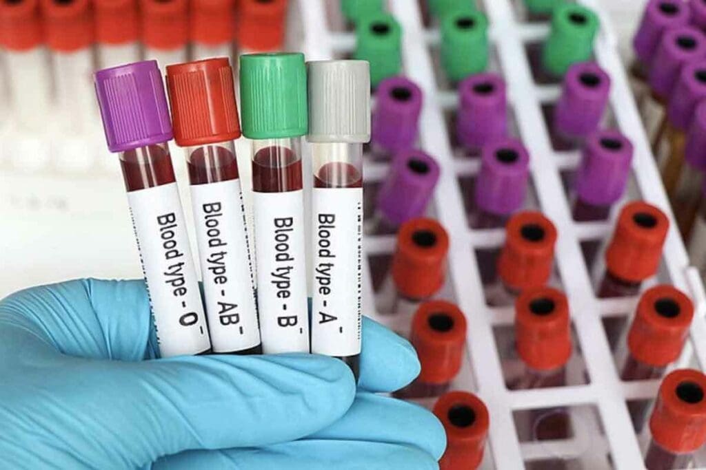 O Positive Blood Type: 9 Key Facts, Benefits, and Compatibility Explained 3 O Positive Blood Type: 9 Key Facts, Benefits, and Compatibility Explained