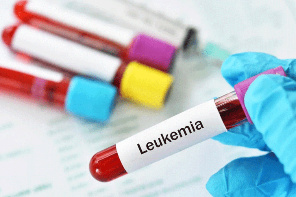 Breakthrough Drug: Is gleevec the Miracle Drug for Leukemia Treatment? 1 Breakthrough Drug: Is gleevec the Miracle Drug for Leukemia Treatment?