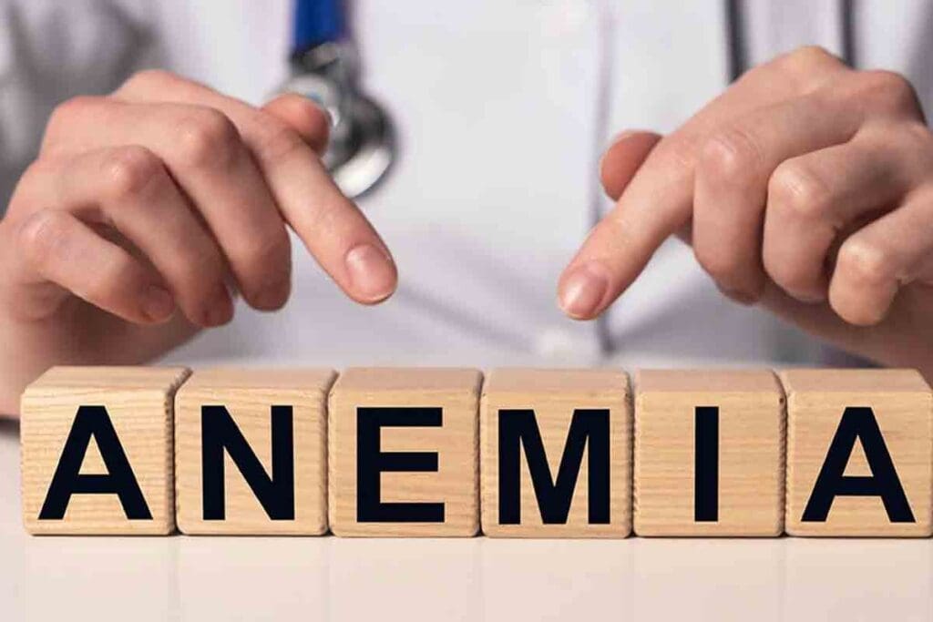 Anemia Test at Home: Step‑by‑Step Iron and Hemoglobin Testing Guide