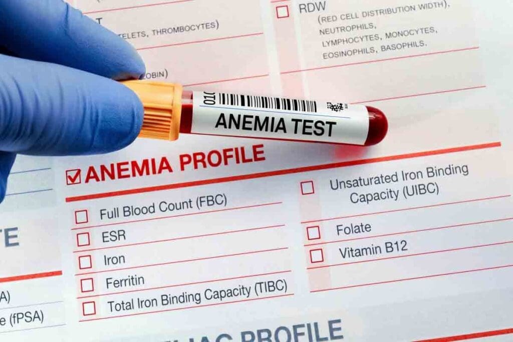 Anemia Test at Home: Step‑by‑Step Iron and Hemoglobin Testing Guide