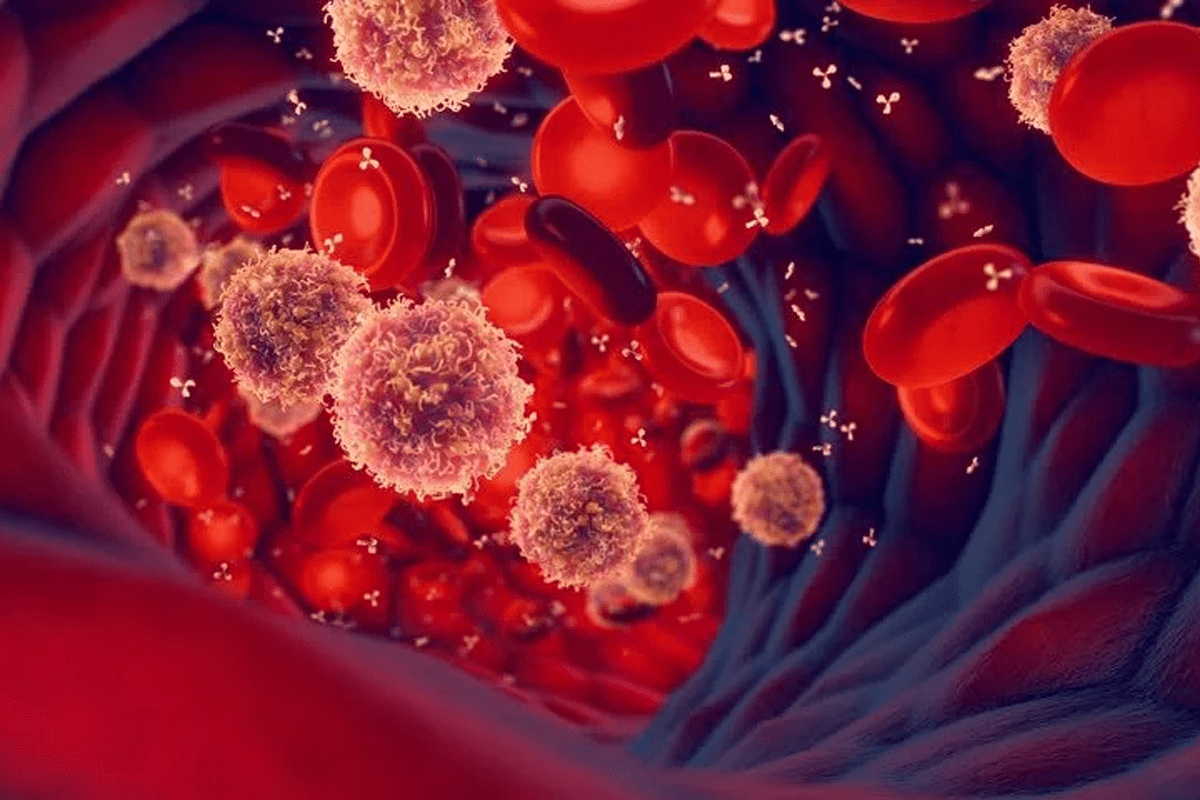 What Type of Cancer Causes Low Hemoglobin? Crucial