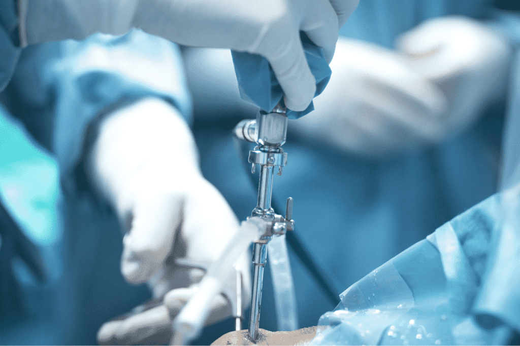 Kidney Removal Surgery: An Essential Guide