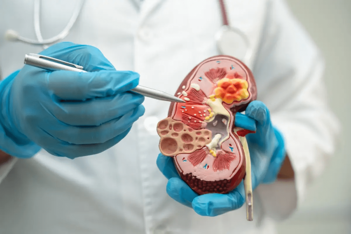Kidney Removal Surgery: Your Ultimate Guide