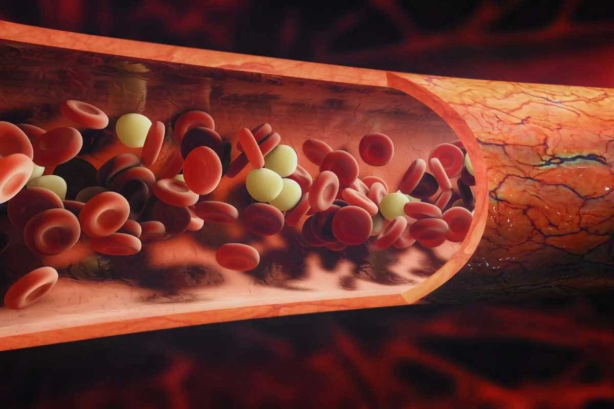7 Different Kinds of Blood Clots Explained: Names, Characteristics, and Risks