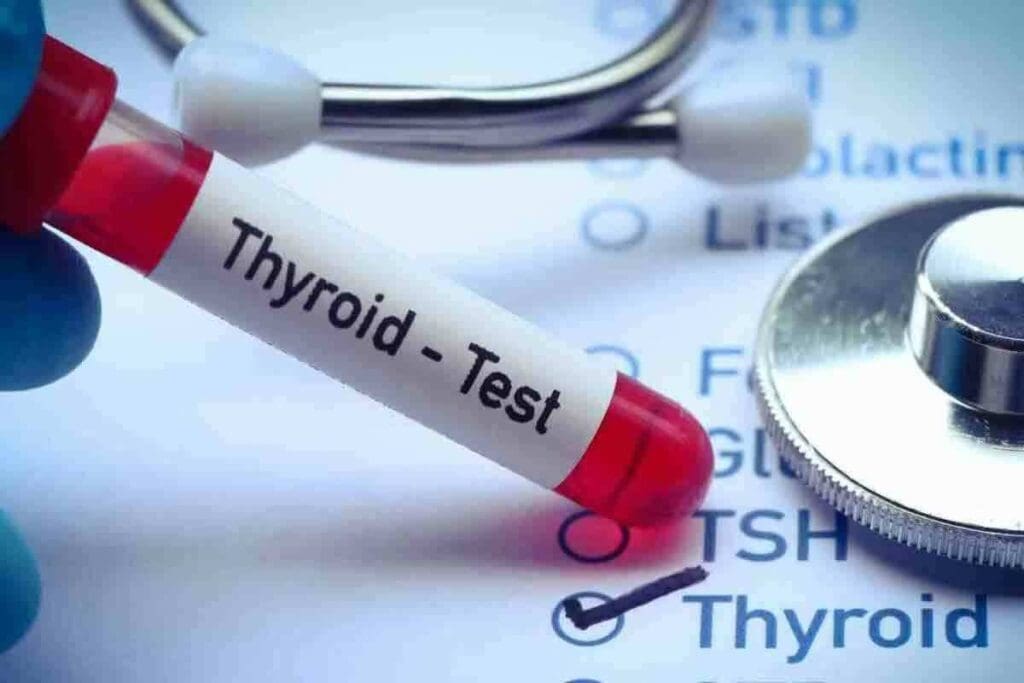  I 131 Scan: Key Uses and Post-Thyroidectomy Steps