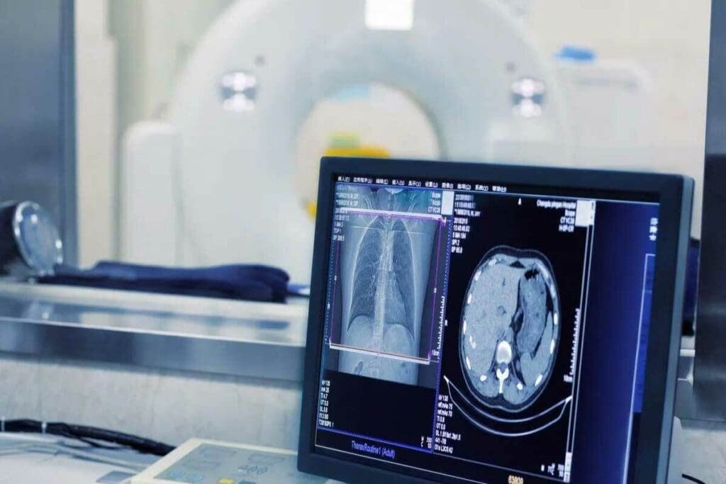 How Often Can You Get CT Scans? The Best Ultimate Guide