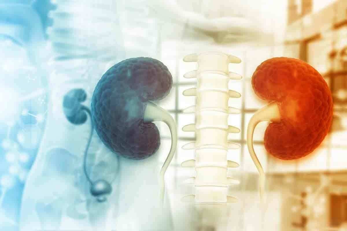 Lasix Kidney Scan: Results, Interpretation & Facts