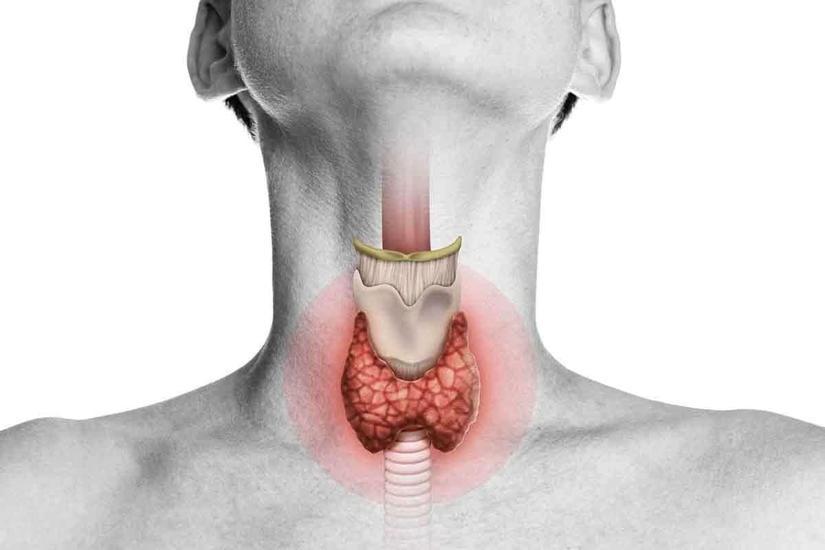Thyroid Gland Xray: 7 Crucial Facts on Cancer Detection