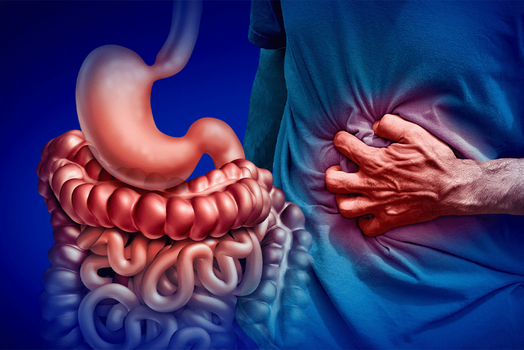 AVM: Critical Congenital Disorder of Intestinal Nerves