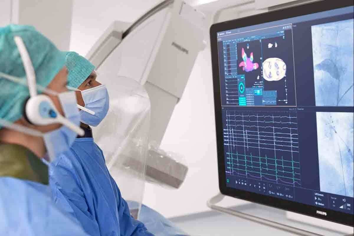 Cardiac SPECT Imaging: The Ultimate & Amazing Guide