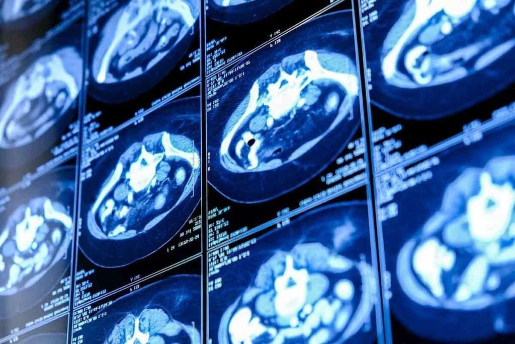 CT Scan Time Frame: The Ultimate & Powerful Guide