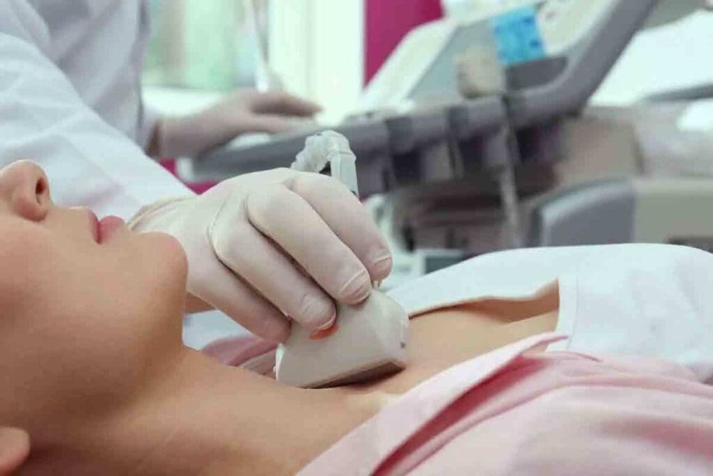 TSH Levels After Radioactive Iodine Treatment